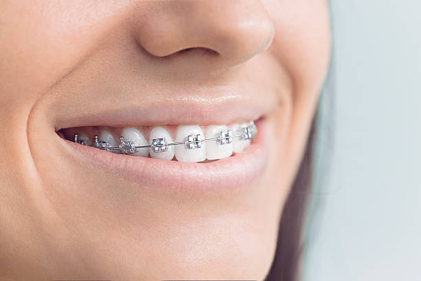 Best Dental Exams and Cleanings  in Lake Mack Forest Hills, FL